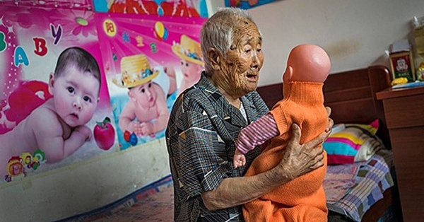 이수단(1922-2016) 북한 평안남도 생, 1940년, 18세에 5년간 중국 아청, 시먼즈 위안소로 동원돼 중국에 남겨진 조선인이다. 이수단 피해자는 당시의 상처로 자신의 아이를 임신할 수 없었고, 2016년 95세의 나이에 홀로 경로원에서 외로운 사투를 벌이다 운명을 달리했다.