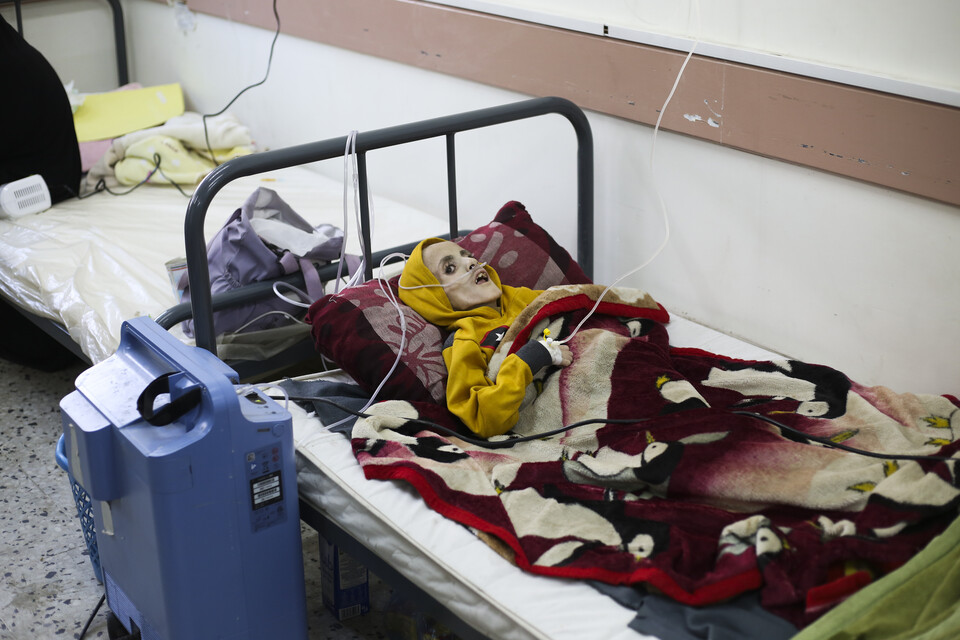 지난 3일(현지시각) 뇌성마비로 태어난 올해 10살 팔레스타인 소년 야잔 알 카파르나 라파의 한 병원에 누워 있다. 의사에 따르면 야잔은 영양 부족에 따른 인한 극심한 근육 소모로 최근 사망했다. ⓒAP 연합뉴스