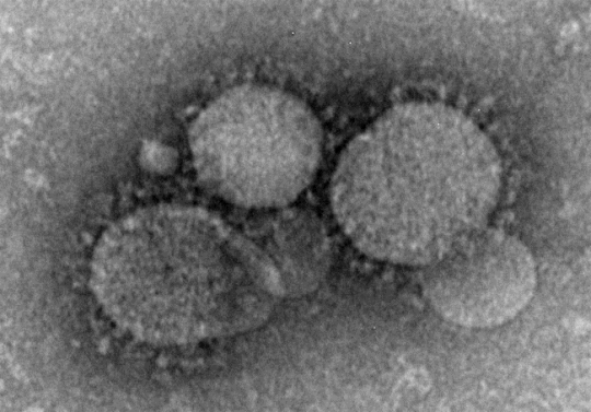 현미경으로 본 중동호흡기증후군 바이러스 ⓒ미국 질병통제예방센터(CDC) 홈페이지