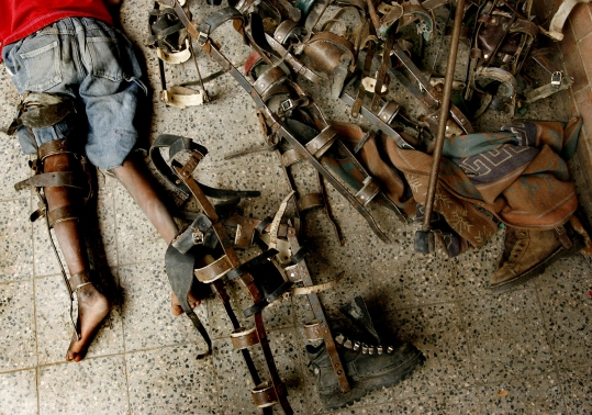 2006년 11월 20일, 콩고민주공화국 수도 킨샤샤의 국제소아마비희생자 대응위원회(International Polio Victim Response Committee, IPVRC) 구내 한 어린이가 임시로 만든 목발 옆에 누워있다. 당시 콩고의 의료관리체계는 수년간에 걸친 분쟁으로 인해 제대로 기능하지 못하고 있었다. ⓒ로이터 사진전 사무국 제공