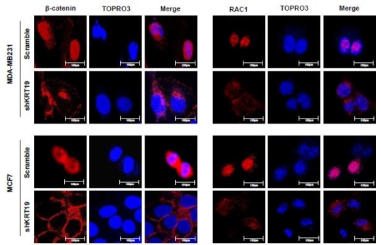 건국대학교 연구팀이 유방암 진행을 억제하는 단백질을 처음으로 발견했다. 사진은 연구팀 연구자료. ⓒ건국대학교