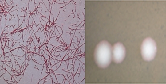 (왼쪽부터)0.05% basic fuchsin으로 염색한 레지오넬라균(1000배)과 해부현미경으로 관찰한 레지오넬라균 집락사진(100배). ⓒ질병관리본부