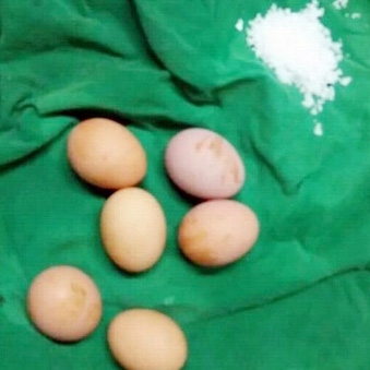 인천 한 산부인과 직원이 의료기기로 달걀을 삶은 사진을 SNS에 게재해 논란이 일고 있다. ⓒ페이스북 화면 캡쳐